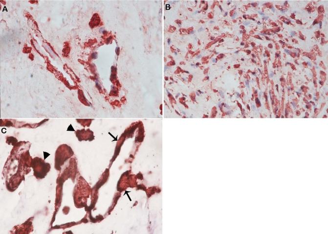 https://cdn.ncbi.nlm.nih.gov/pmc/blobs/9f67/2893050/810cc6b48213/mv-v16-1098-f3.jpg