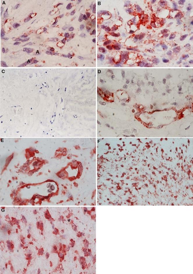 https://cdn.ncbi.nlm.nih.gov/pmc/blobs/9f67/2893050/ad66e9012633/mv-v16-1098-f2.jpg