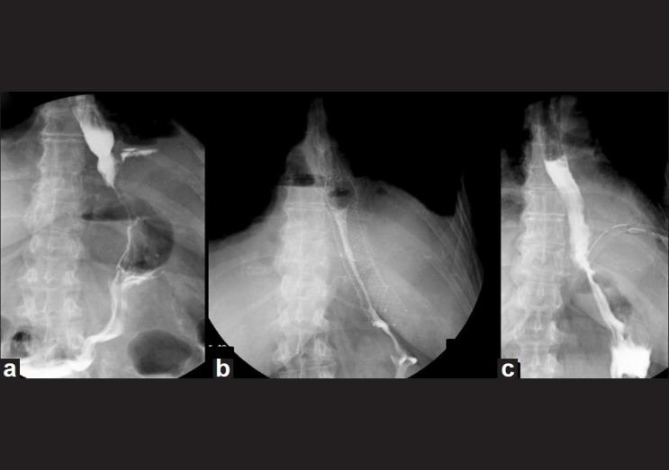 https://cdn.ncbi.nlm.nih.gov/pmc/blobs/9f71/3523447/2718db4907c9/JMAS-8-118-g002.jpg