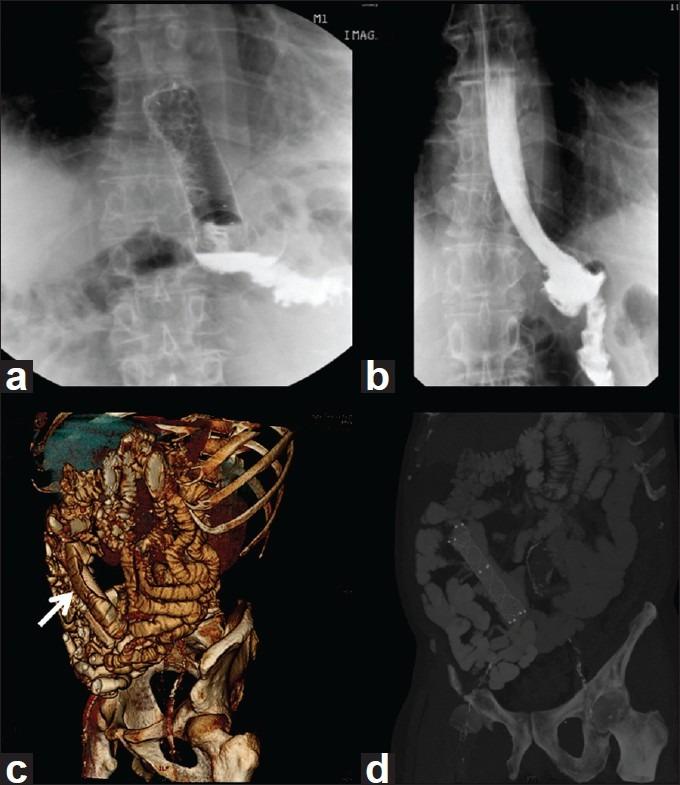 https://cdn.ncbi.nlm.nih.gov/pmc/blobs/9f71/3523447/7dde0ed6c9bd/JMAS-8-118-g005.jpg