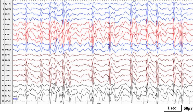 https://cdn.ncbi.nlm.nih.gov/pmc/blobs/9f72/8060571/9eca18b830da/fgene-12-607965-g004.jpg