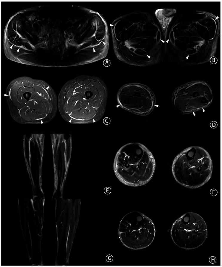 https://cdn.ncbi.nlm.nih.gov/pmc/blobs/9f7b/12087228/867a3a011a8b/13075_2025_3574_Fig2_HTML.jpg