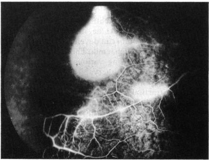 https://cdn.ncbi.nlm.nih.gov/pmc/blobs/9f81/1041358/4964f78e6b5f/brjopthal00605-0014-c.jpg