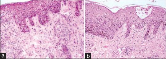 https://cdn.ncbi.nlm.nih.gov/pmc/blobs/9f8b/7982049/2b40beb7c8e1/IDOJ-12-78-g005.jpg