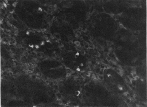 https://cdn.ncbi.nlm.nih.gov/pmc/blobs/9f8f/1412259/f64e6e1f429d/gut00645-0059-a.jpg