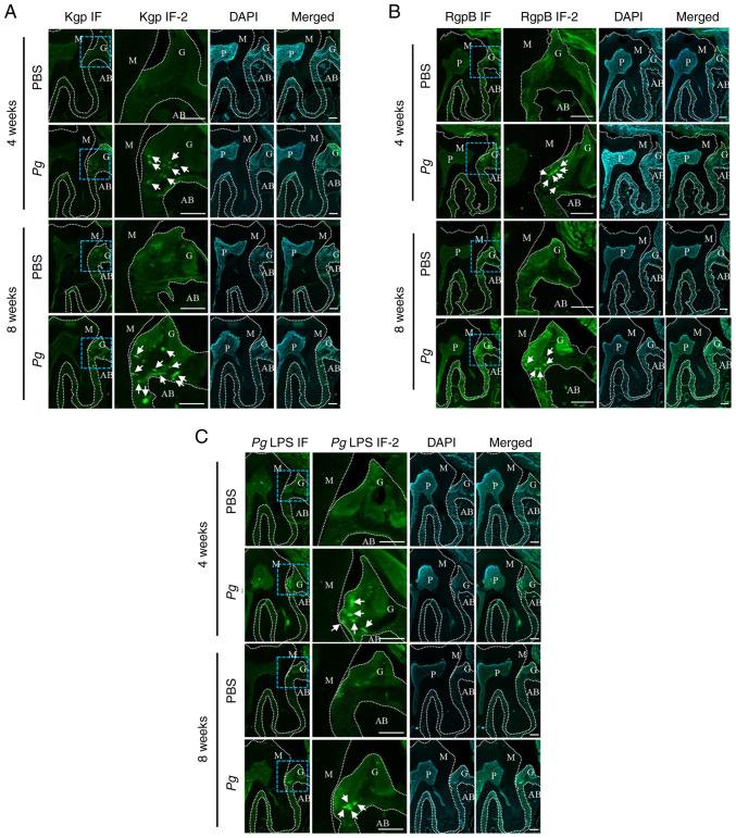 https://cdn.ncbi.nlm.nih.gov/pmc/blobs/9f90/9242655/5b1d94be3e7d/IJMM-50-02-05159-g05.jpg