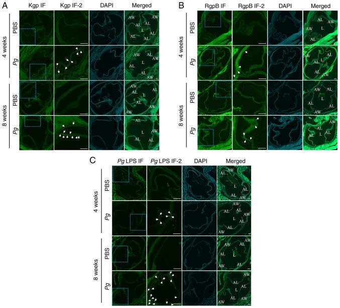 https://cdn.ncbi.nlm.nih.gov/pmc/blobs/9f90/9242655/89b6693d4a28/IJMM-50-02-05159-g06.jpg