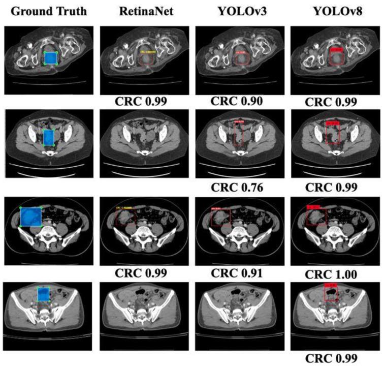 https://cdn.ncbi.nlm.nih.gov/pmc/blobs/9f91/10451186/5c2e94018494/bioengineering-10-00972-g005.jpg