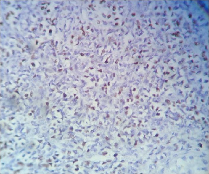 https://cdn.ncbi.nlm.nih.gov/pmc/blobs/9f94/5553242/5126c136f2bf/JRMS-22-83-g006.jpg