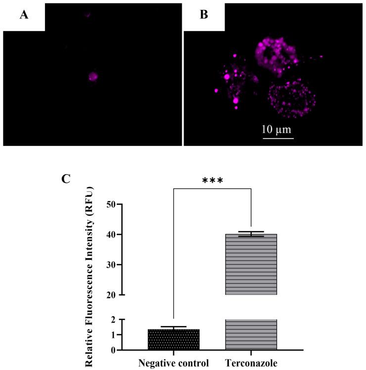 https://cdn.ncbi.nlm.nih.gov/pmc/blobs/9f95/11206913/819982420e16/pharmaceuticals-17-00808-g008.jpg