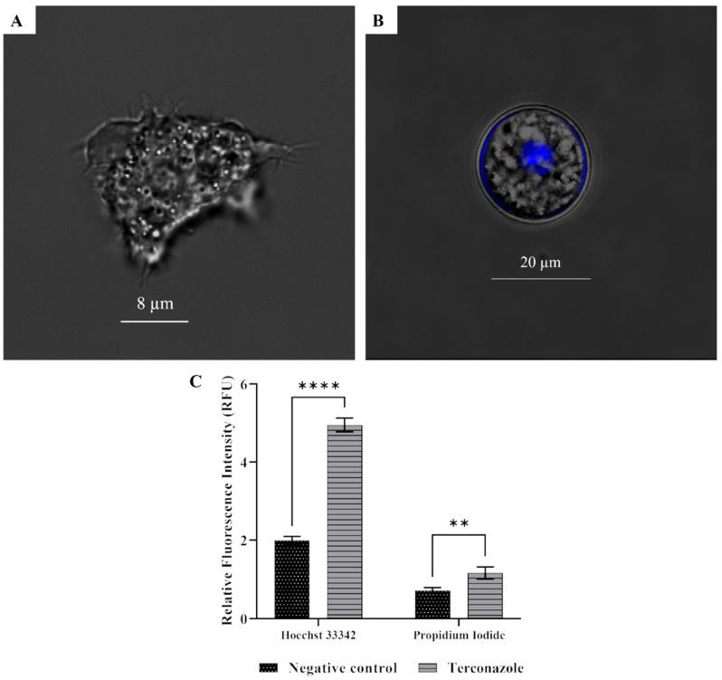 https://cdn.ncbi.nlm.nih.gov/pmc/blobs/9f95/11206913/8bd787329ceb/pharmaceuticals-17-00808-g005.jpg