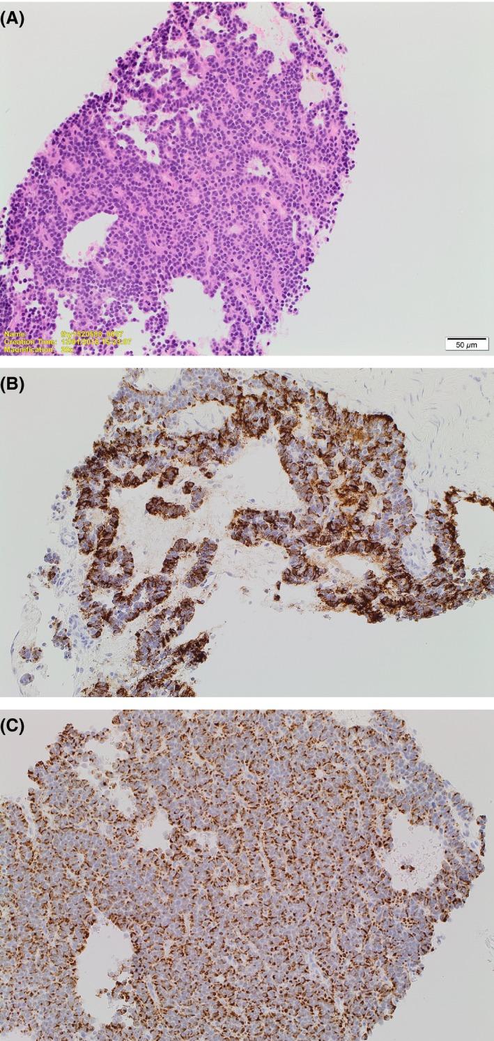 https://cdn.ncbi.nlm.nih.gov/pmc/blobs/9f97/5676263/61c3b56a1863/CCR3-5-1768-g001.jpg