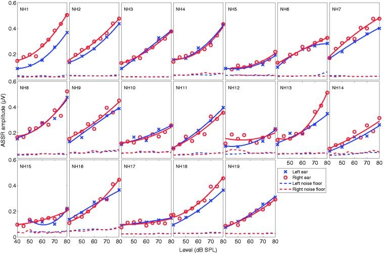 https://cdn.ncbi.nlm.nih.gov/pmc/blobs/9f97/6196616/c86614d84fdb/10.1177_2331216518805352-fig4.jpg