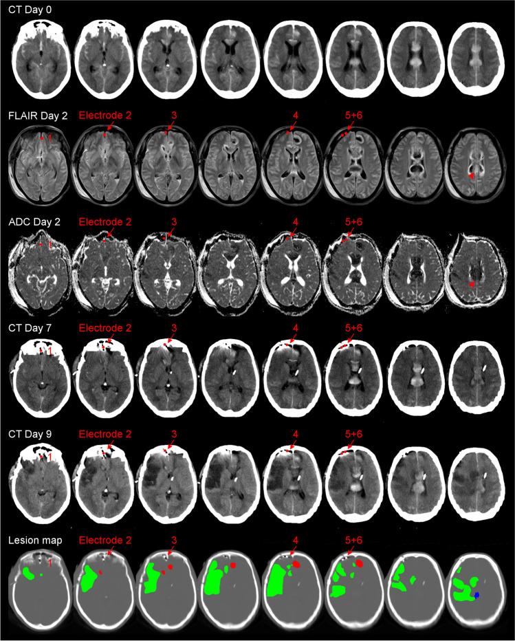 https://cdn.ncbi.nlm.nih.gov/pmc/blobs/9f9b/11772537/21dfaf7048e9/12975_2024_1237_Fig1_HTML.jpg