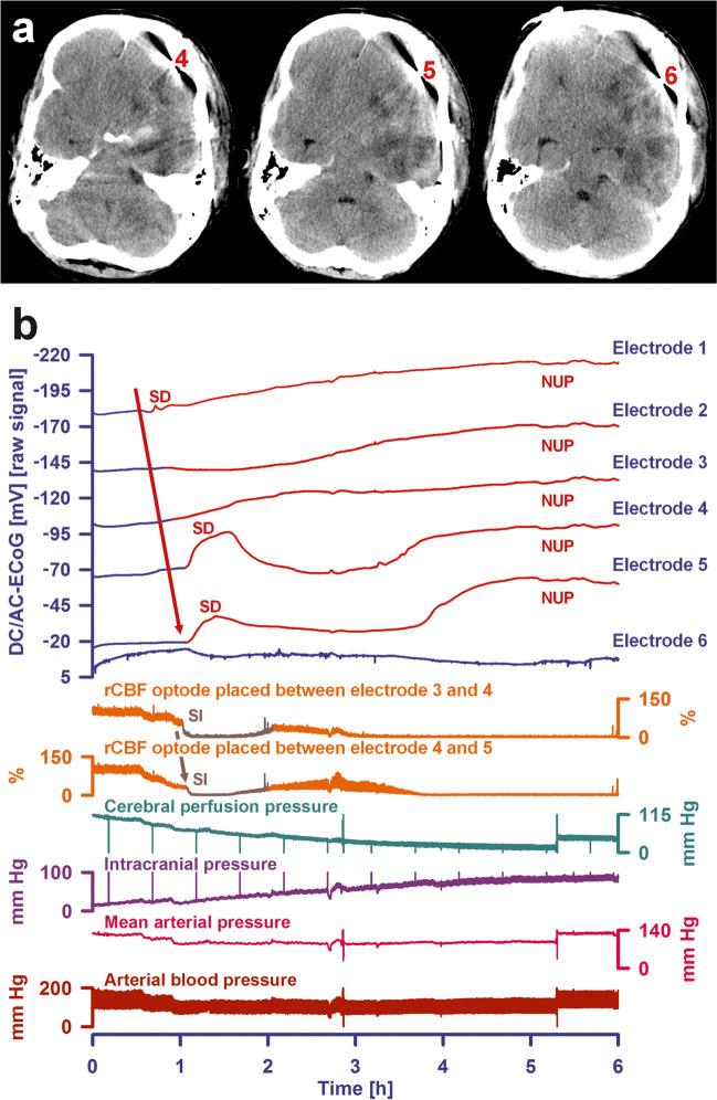 https://cdn.ncbi.nlm.nih.gov/pmc/blobs/9f9b/11772537/edc05c50cad5/12975_2024_1237_Fig5_HTML.jpg