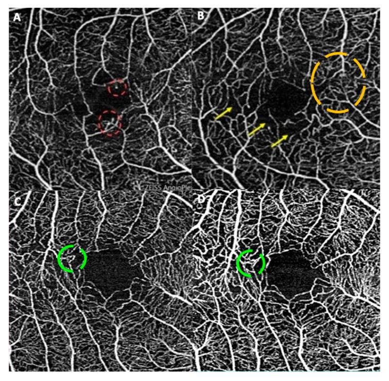 https://cdn.ncbi.nlm.nih.gov/pmc/blobs/9f9c/11505013/62868d839129/biomedicines-12-02414-g001.jpg