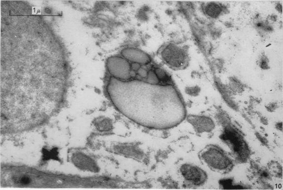 https://cdn.ncbi.nlm.nih.gov/pmc/blobs/9f9f/1244168/4793ab20b0e5/janat00430-0023-c.jpg