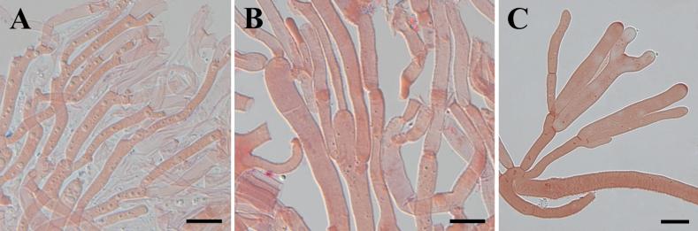 https://cdn.ncbi.nlm.nih.gov/pmc/blobs/9fa3/11336384/2f19f543d32a/mycokeys-107-327-g008.jpg