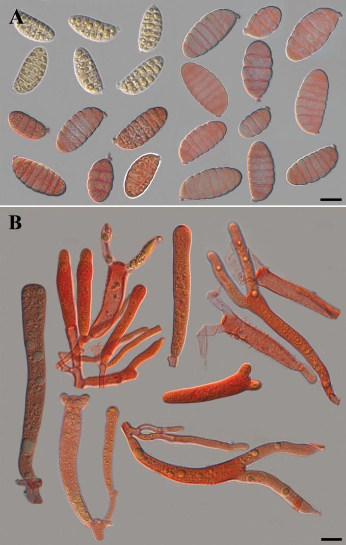 https://cdn.ncbi.nlm.nih.gov/pmc/blobs/9fa3/11336384/533a28f0ea82/mycokeys-107-327-g010.jpg