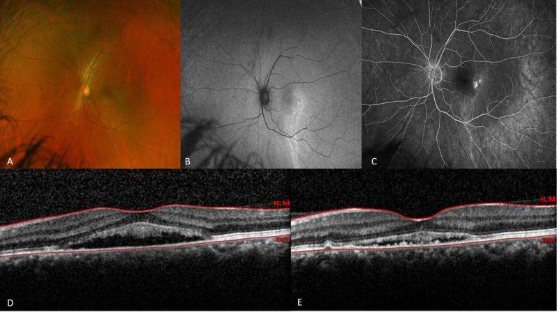 https://cdn.ncbi.nlm.nih.gov/pmc/blobs/9fad/11921750/06572ef8d854/40942_2025_657_Fig3_HTML.jpg