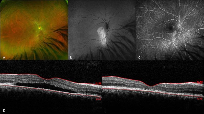 https://cdn.ncbi.nlm.nih.gov/pmc/blobs/9fad/11921750/91cd32f7ab96/40942_2025_657_Fig2_HTML.jpg