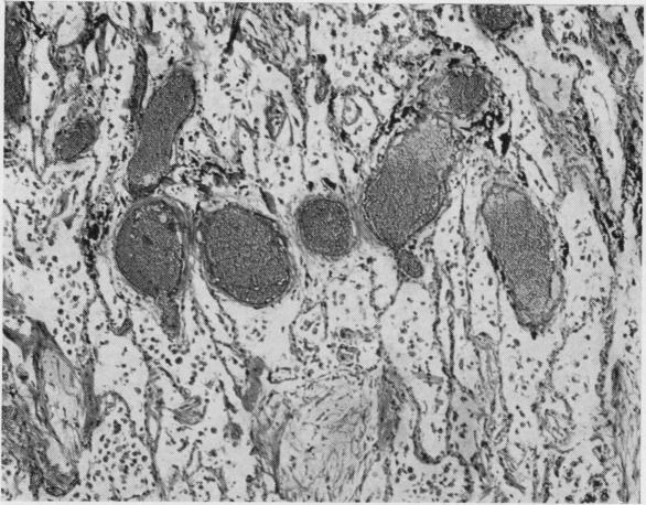 https://cdn.ncbi.nlm.nih.gov/pmc/blobs/9faf/480207/2a2c65a1f566/jclinpath00062-0037-a.jpg
