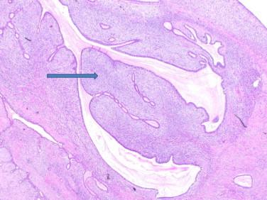 https://cdn.ncbi.nlm.nih.gov/pmc/blobs/9fbb/4446672/3ea4887d8847/gr2.jpg