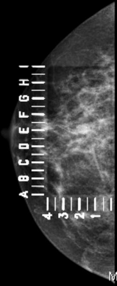https://cdn.ncbi.nlm.nih.gov/pmc/blobs/9fbb/4446672/dec8941b1758/gr1.jpg