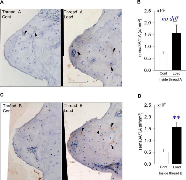 https://cdn.ncbi.nlm.nih.gov/pmc/blobs/9fbc/5731745/548a8757b934/pone.0189893.g004.jpg
