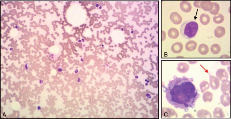 https://cdn.ncbi.nlm.nih.gov/pmc/blobs/9fbf/5690751/b49ff063596e/medi-96-e8529-g001.jpg