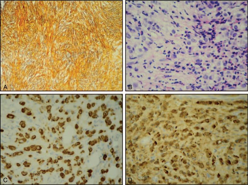 https://cdn.ncbi.nlm.nih.gov/pmc/blobs/9fbf/5690751/cd4f7d8c976f/medi-96-e8529-g002.jpg