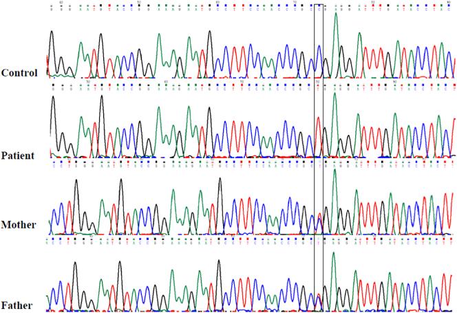 https://cdn.ncbi.nlm.nih.gov/pmc/blobs/9fc0/7600365/e10c9afba9a3/gr3.jpg