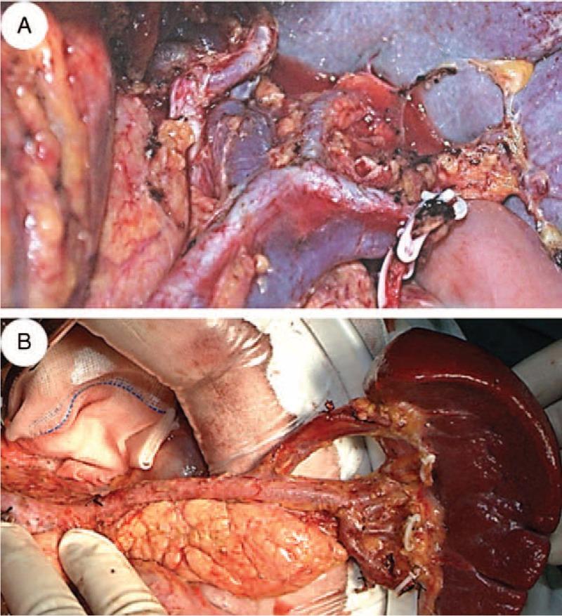 https://cdn.ncbi.nlm.nih.gov/pmc/blobs/9fc1/4616434/609714fe5d00/medi-94-e1305-g001.jpg