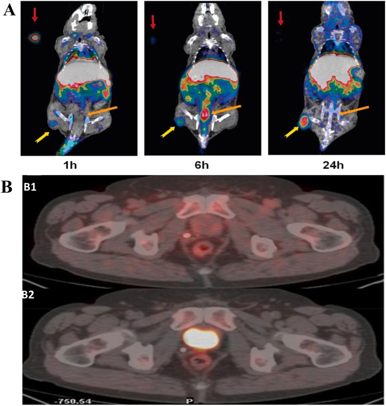 https://cdn.ncbi.nlm.nih.gov/pmc/blobs/9fc2/12391698/4f2c8d4700a1/gr5.jpg