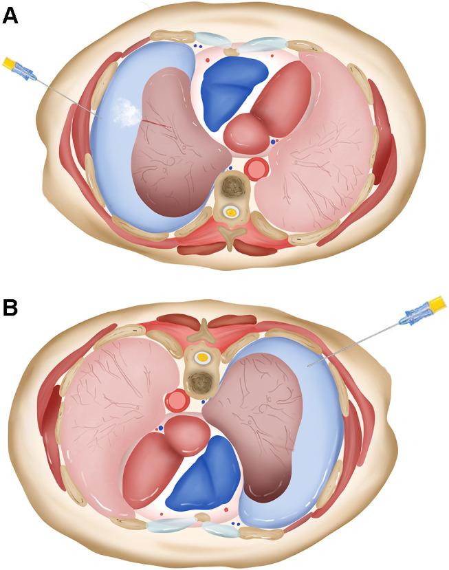 https://cdn.ncbi.nlm.nih.gov/pmc/blobs/9fca/8001193/866f3edff056/IJGM-14-1013-g0001.jpg