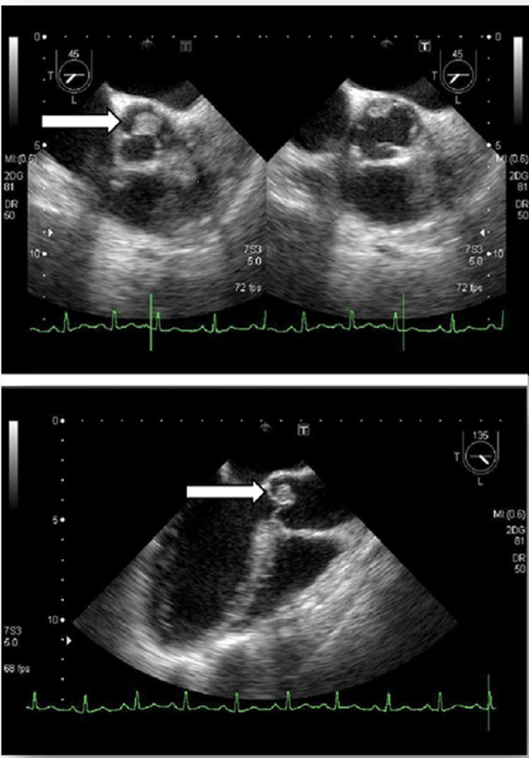 https://cdn.ncbi.nlm.nih.gov/pmc/blobs/9fd4/9366033/72f3ede99450/cureus-0014-00000026791-i04.jpg