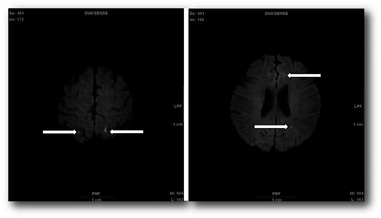 https://cdn.ncbi.nlm.nih.gov/pmc/blobs/9fd4/9366033/758b08b12f19/cureus-0014-00000026791-i03.jpg
