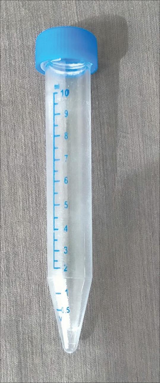https://cdn.ncbi.nlm.nih.gov/pmc/blobs/9fd8/8664176/3dc1d34e9cdc/IDOJ-12-12-g002.jpg