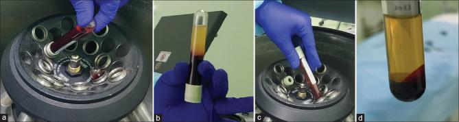 https://cdn.ncbi.nlm.nih.gov/pmc/blobs/9fd8/8664176/7977576eddfa/IDOJ-12-12-g005.jpg