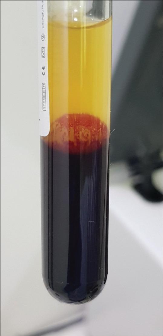 https://cdn.ncbi.nlm.nih.gov/pmc/blobs/9fd8/8664176/f83ffd83662c/IDOJ-12-12-g008.jpg