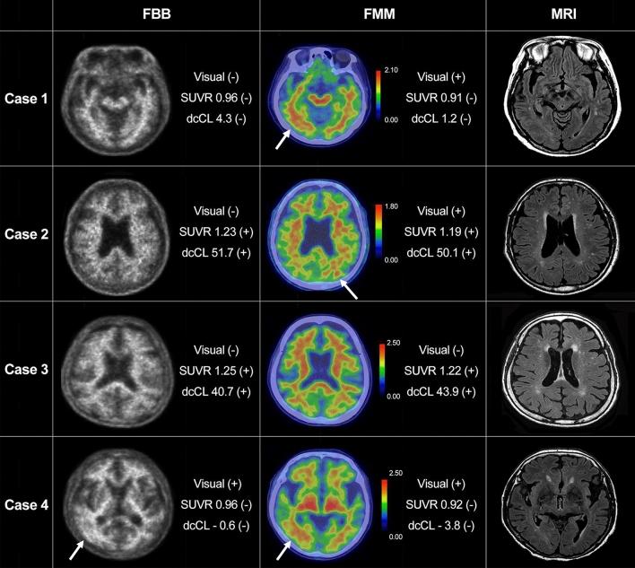 https://cdn.ncbi.nlm.nih.gov/pmc/blobs/9fd9/7658982/e3e2844ae815/41598_2020_76102_Fig2_HTML.jpg
