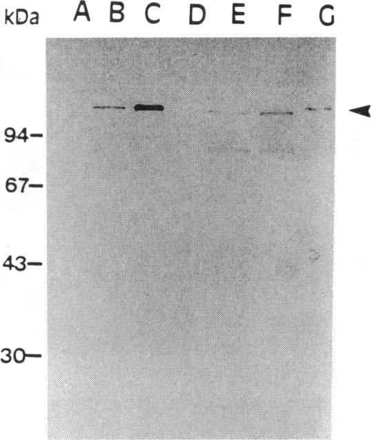 https://cdn.ncbi.nlm.nih.gov/pmc/blobs/9fe1/205360/222a2297c967/jbacter00026-0245-a.jpg