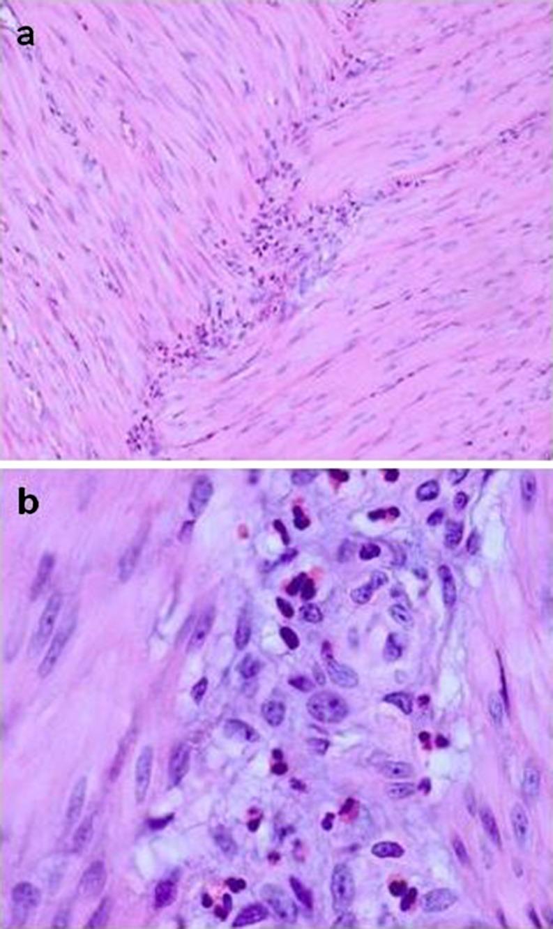 https://cdn.ncbi.nlm.nih.gov/pmc/blobs/9fe2/3267033/04a29a36eaf9/428_2011_1183_Fig1_HTML.jpg
