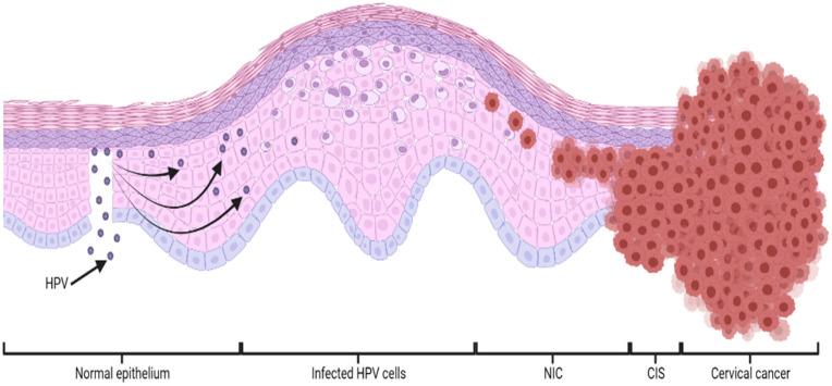 https://cdn.ncbi.nlm.nih.gov/pmc/blobs/9fe5/9137930/1ef4c727805d/bioengineering-09-00197-g001.jpg