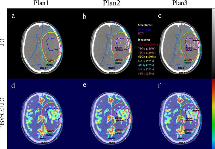 https://cdn.ncbi.nlm.nih.gov/pmc/blobs/9fe9/9974719/e4091ae8c193/11604_2022_1357_Fig3_HTML.jpg