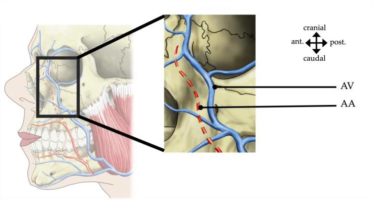 https://cdn.ncbi.nlm.nih.gov/pmc/blobs/9fea/11123074/b665bf55e35e/medicina-60-00805-g004.jpg
