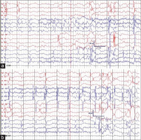 https://cdn.ncbi.nlm.nih.gov/pmc/blobs/9ff2/9350788/5df840a2d2fc/AIAN-25-495-g001.jpg