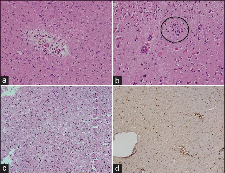 https://cdn.ncbi.nlm.nih.gov/pmc/blobs/9ff2/9350788/89f628d52018/AIAN-25-495-g003.jpg