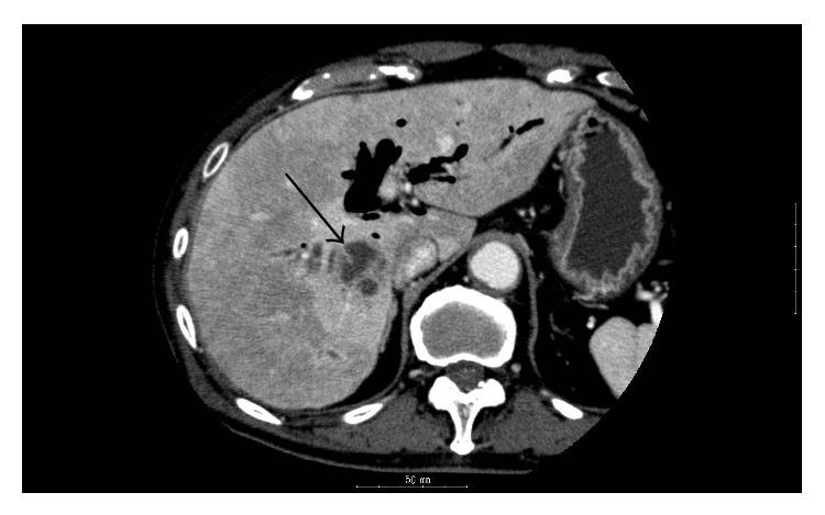 https://cdn.ncbi.nlm.nih.gov/pmc/blobs/9ff5/4302366/7b315b5421f7/CRIID2015-354168.001.jpg