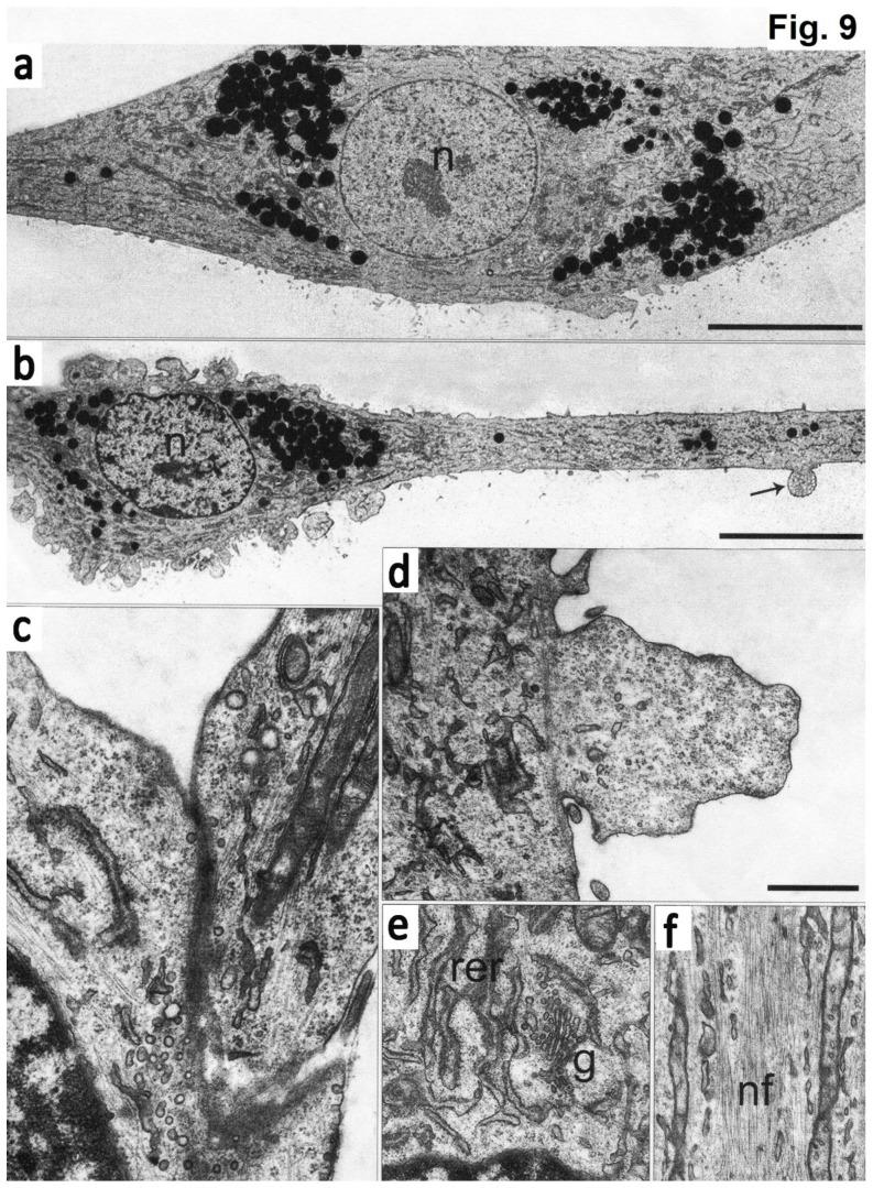 https://cdn.ncbi.nlm.nih.gov/pmc/blobs/9ff5/5859766/06e1b1de0b0e/ijmsv15p0436g009.jpg